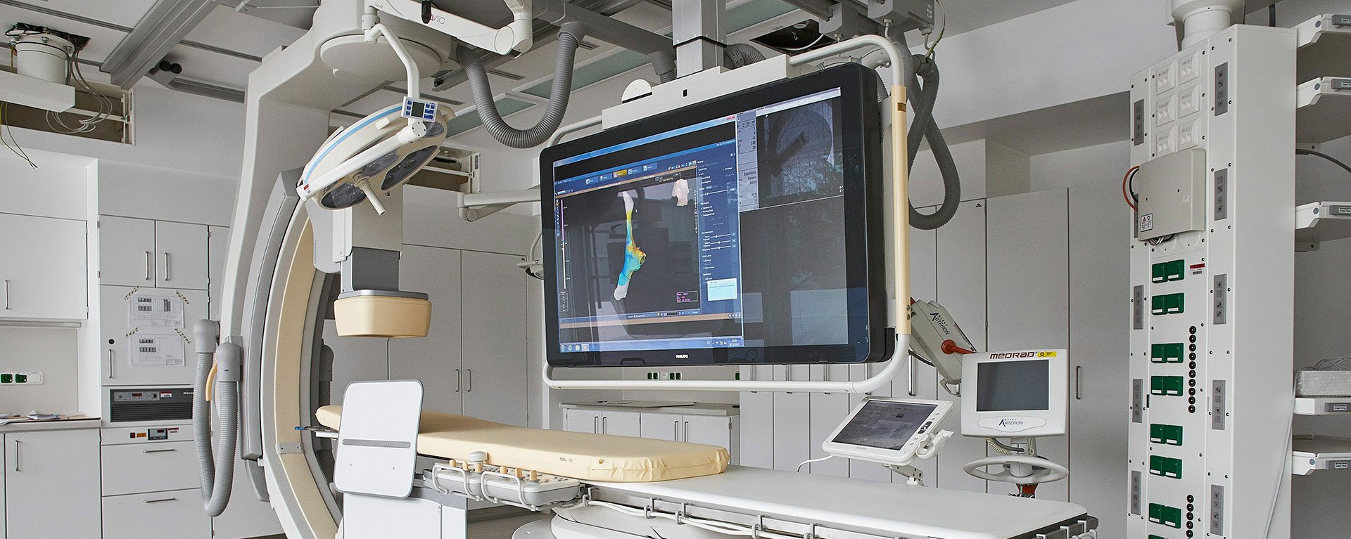Behandlungsraum im Herz- & Gefäßzentrum Kempten-Oberallgäu mit einem großen Screen über der Behandlungsliege
