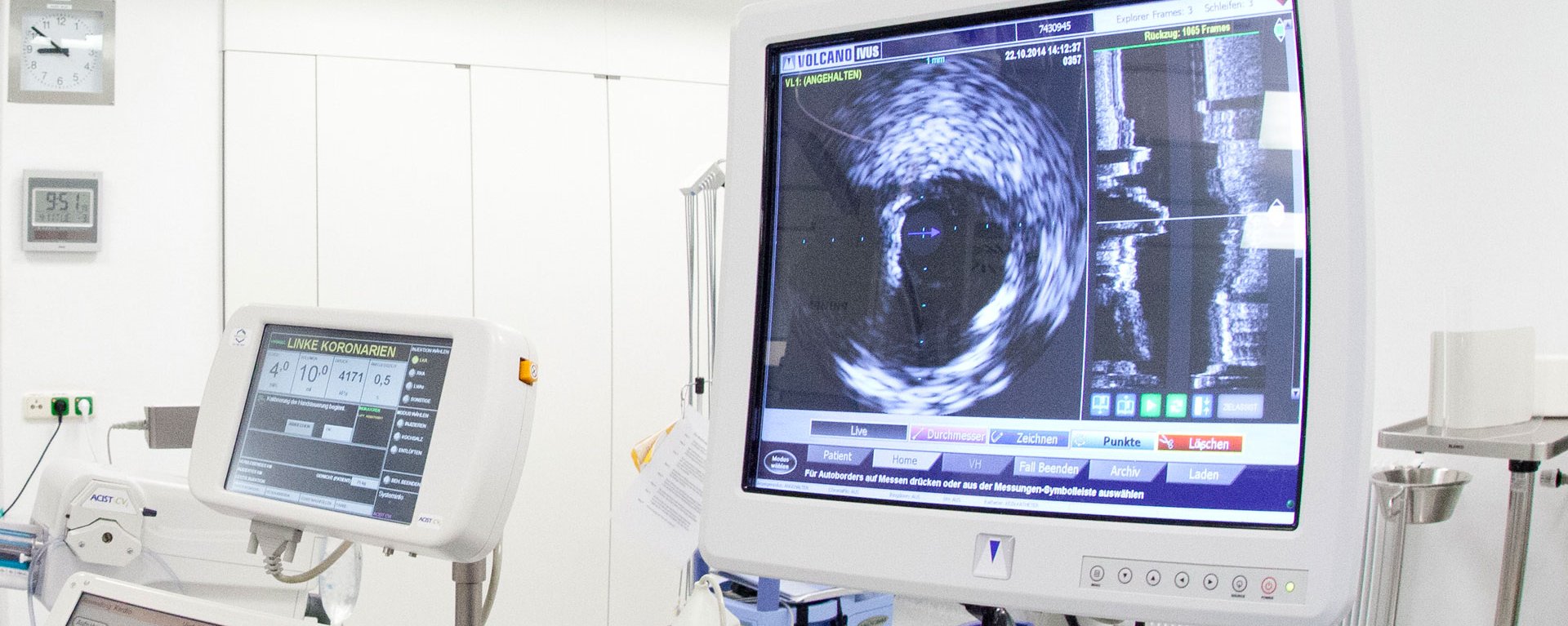 Elektrophysiologie ist ein bildgebendes Verfahren – im Bild ist ein Monitor innerhalb eines Operationssaals zu sehen, der solche Bilder ausgeben kann