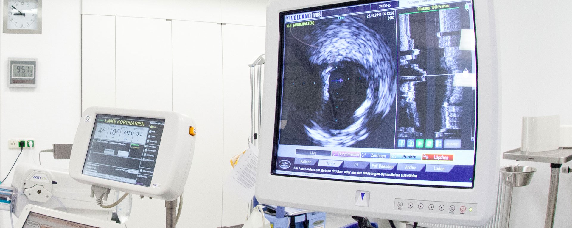 Elektrophysiologie ist ein bildgebendes Verfahren – im Bild ist ein Monitor innerhalb eines Operationssaals zu sehen, der solche Bilder ausgeben kann
